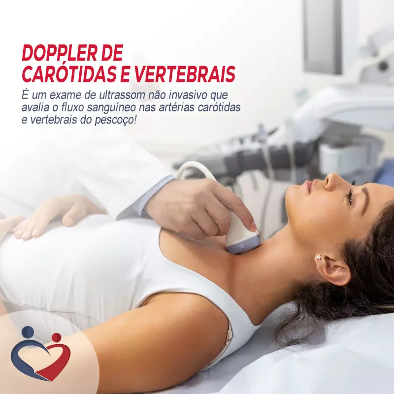 Doppler de Carótidas e Vertebrais